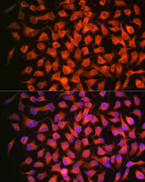 Anti-RAR&#946; Antibody, clone 6D5V4, Rabbit Monoclonal