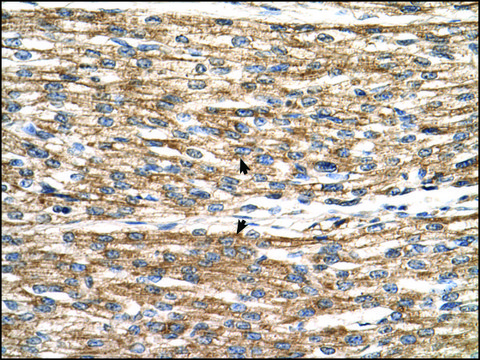 Anti-PNPLA3 antibody produced in rabbit affinity isolated antibody