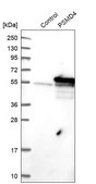 Anti-PSMD4 antibody produced in rabbit Prestige Antibodies® Powered by Atlas Antibodies, affinity isolated antibody, buffered aqueous glycerol solution