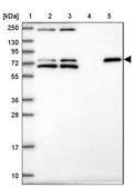 Anti-ZNF510 antibody produced in rabbit Prestige Antibodies® Powered by Atlas Antibodies, affinity isolated antibody, buffered aqueous glycerol solution
