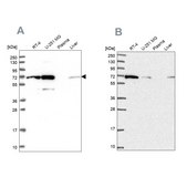 Anti-IRGQ antibody produced in rabbit Prestige Antibodies® Powered by Atlas Antibodies, affinity isolated antibody, buffered aqueous glycerol solution
