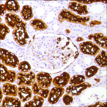 Anti-CD13 antibody, Rabbit monoclonal clone SP182, recombinant, expressed in proprietary host, affinity isolated antibody