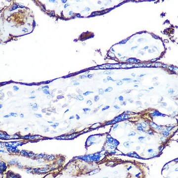 Anti-CD55 antibody produced in rabbit