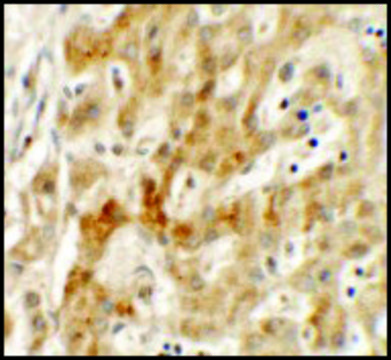 Anti-TMEM106B antibody produced in rabbit affinity isolated antibody