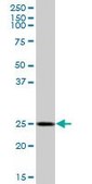 Anti-GOSR1 antibody produced in mouse IgG fraction of antiserum, buffered aqueous solution