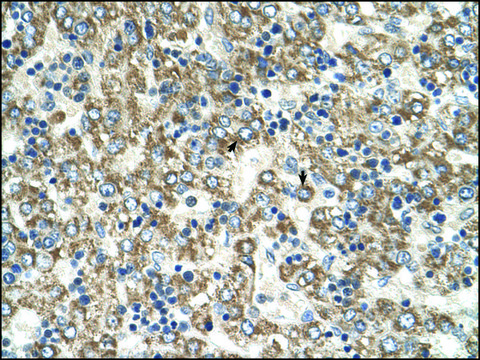 Anti-GOT2 (AB2) antibody produced in rabbit IgG fraction of antiserum