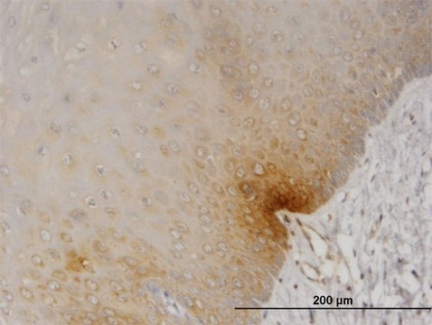 Monoclonal Anti-DYRK2, (N-terminal) antibody produced in mouse clone 2F9, purified immunoglobulin, buffered aqueous solution