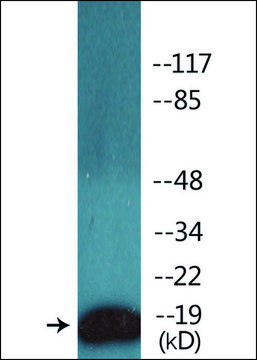 Anti-phospho-CD3 &#950; (pTyr142) antibody produced in rabbit affinity isolated antibody