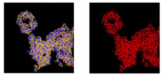 抗-寡糖-2 抗体 from rabbit, purified by affinity chromatography