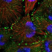 Anti-CARD6 antibody produced in rabbit Prestige Antibodies® Powered by Atlas Antibodies, affinity isolated antibody, buffered aqueous glycerol solution