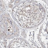 Anti-HOXA3 antibody produced in rabbit Prestige Antibodies® Powered by Atlas Antibodies, affinity isolated antibody, buffered aqueous glycerol solution