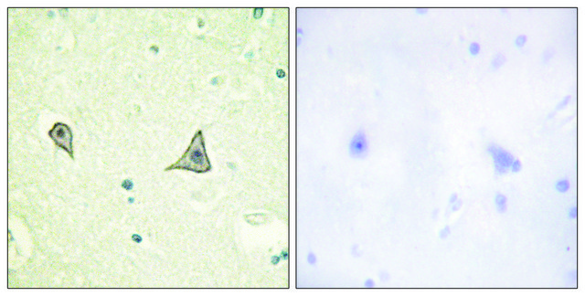 Anti-M-CSF Receptor antibody produced in rabbit affinity isolated antibody