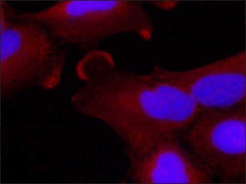 Monoclonal Anti-EXOC6 antibody produced in mouse ~1.0&#160;mg/mL, clone 15S2G6, purified immunoglobulin