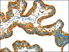 Anti-TRPV5 affinity isolated antibody