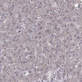 Anti-SLC22A18 antibody produced in rabbit Prestige Antibodies® Powered by Atlas Antibodies, affinity isolated antibody