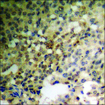 Anti-phospho-TNNI3 (pSer22+Ser23) antibody produced in rabbit affinity isolated antibody