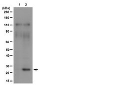 Anti-phospho-Bcl-2 (Ser70) Antibody, clone 69-10C-2-10C-18, rabbit monoclonal clone 69-10C-2-10C-18, from rabbit, unconjugated