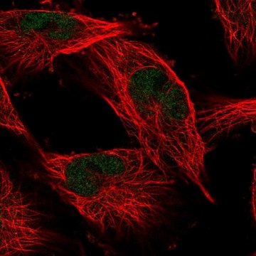 Anti-COMMD1 antibody produced in rabbit Prestige Antibodies&#174; Powered by Atlas Antibodies, affinity isolated antibody