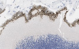 Anti-Bestrophin-1 Antibody, clone E6-6 ZooMAb® Mouse Monoclonal recombinant, expressed in HEK 293 cells