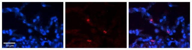 Anti-FCGRT antibody produced in rabbit affinity isolated antibody