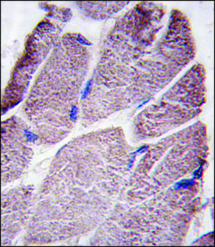 ANTI-PTPD1 (CENTER) antibody produced in rabbit IgG fraction of antiserum, buffered aqueous solution