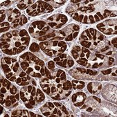 Anti-FBXO33 antibody produced in rabbit Prestige Antibodies® Powered by Atlas Antibodies, affinity isolated antibody, buffered aqueous glycerol solution