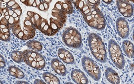 Anti-Cytokeratin-20 Antibody, clone 1E20 ZooMAb® Rabbit Monoclonal recombinant, expressed in HEK 293 cells