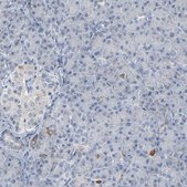 Anti-GPX2 antibody produced in rabbit Prestige Antibodies® Powered by Atlas Antibodies, affinity isolated antibody, buffered aqueous glycerol solution