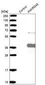 Anti-ANKRD45 antibody produced in rabbit Prestige Antibodies® Powered by Atlas Antibodies, affinity isolated antibody, buffered aqueous glycerol solution, ab3