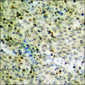 Anti-phospho-Chk1 (pSer317) antibody produced in rabbit affinity isolated antibody
