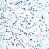 Anti-MCM3 antibody produced in rabbit