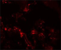 Anti-TM4SF1 antibody produced in rabbit affinity isolated antibody