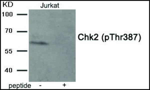 Anti-phospho-Chk2 (pThr387) antibody produced in rabbit affinity isolated antibody