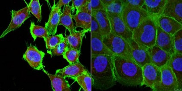 Anti-SCYL1 from rabbit, purified by affinity chromatography