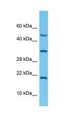 Anti-ATP6V0C antibody produced in rabbit affinity isolated antibody