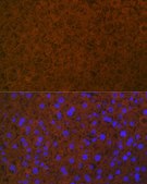 Anti-Coagulation Protein C Antibody, clone 3W3R7, Rabbit Monoclonal