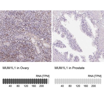 Anti-MUM1L1 antibody produced in rabbit Prestige Antibodies&#174; Powered by Atlas Antibodies, affinity isolated antibody, buffered aqueous glycerol solution