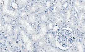 Anti-Cdc42 Antibody, clone 2D16 ZooMAb® Rabbit Monoclonal recombinant, expressed in HEK 293 cells