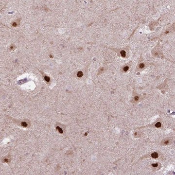 Anti-PSMC2 antibody produced in rabbit Prestige Antibodies&#174; Powered by Atlas Antibodies, affinity isolated antibody