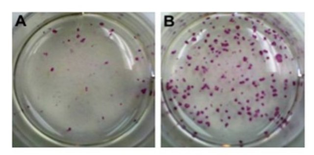 Mouse iPS Reprogramming Boost Supplement The Mouse iPS Reprogramming Boost Supplement enhances the efficiency of mouse iPS colony formation by at least 3-fold.