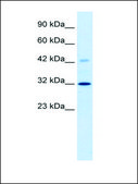 Anti-VDAC1 antibody produced in rabbit IgG fraction of antiserum