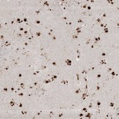 Anti-RBM17 antibody produced in rabbit Prestige Antibodies® Powered by Atlas Antibodies, affinity isolated antibody, buffered aqueous glycerol solution