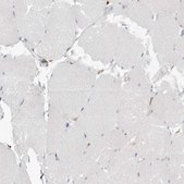 Anti-TPCN2 antibody produced in rabbit Prestige Antibodies® Powered by Atlas Antibodies, affinity isolated antibody, buffered aqueous glycerol solution