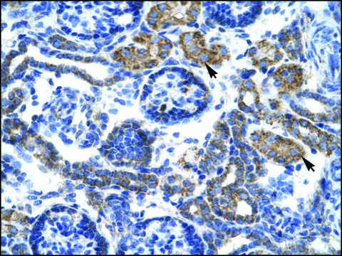 Anti-C4BPB antibody produced in rabbit affinity isolated antibody