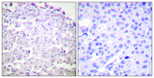 Anti-GADD153 antibody produced in rabbit affinity isolated antibody