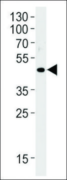 ANTI-OR51E1(C-TERMINAL) antibody produced in rabbit affinity isolated antibody, buffered aqueous solution