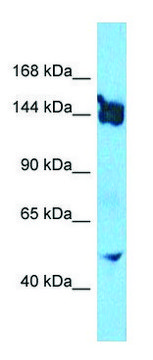 Anti-SLIT3 (N-terminal) antibody produced in rabbit affinity isolated antibody