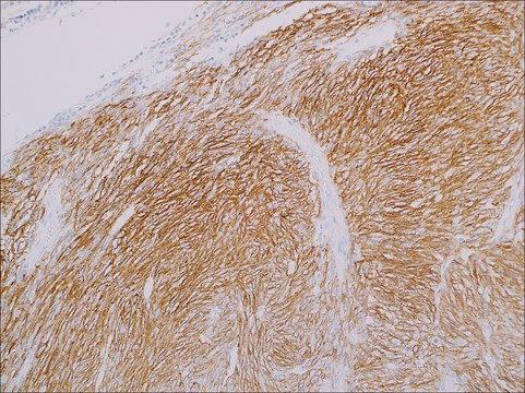 CD35 (EP197) Rabbit Monoclonal Primary Antibody