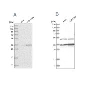 Anti-PDHB antibody produced in rabbit Prestige Antibodies® Powered by Atlas Antibodies, affinity isolated antibody, buffered aqueous glycerol solution