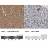 Anti-GDAP1 antibody produced in rabbit Prestige Antibodies® Powered by Atlas Antibodies, affinity isolated antibody, buffered aqueous glycerol solution